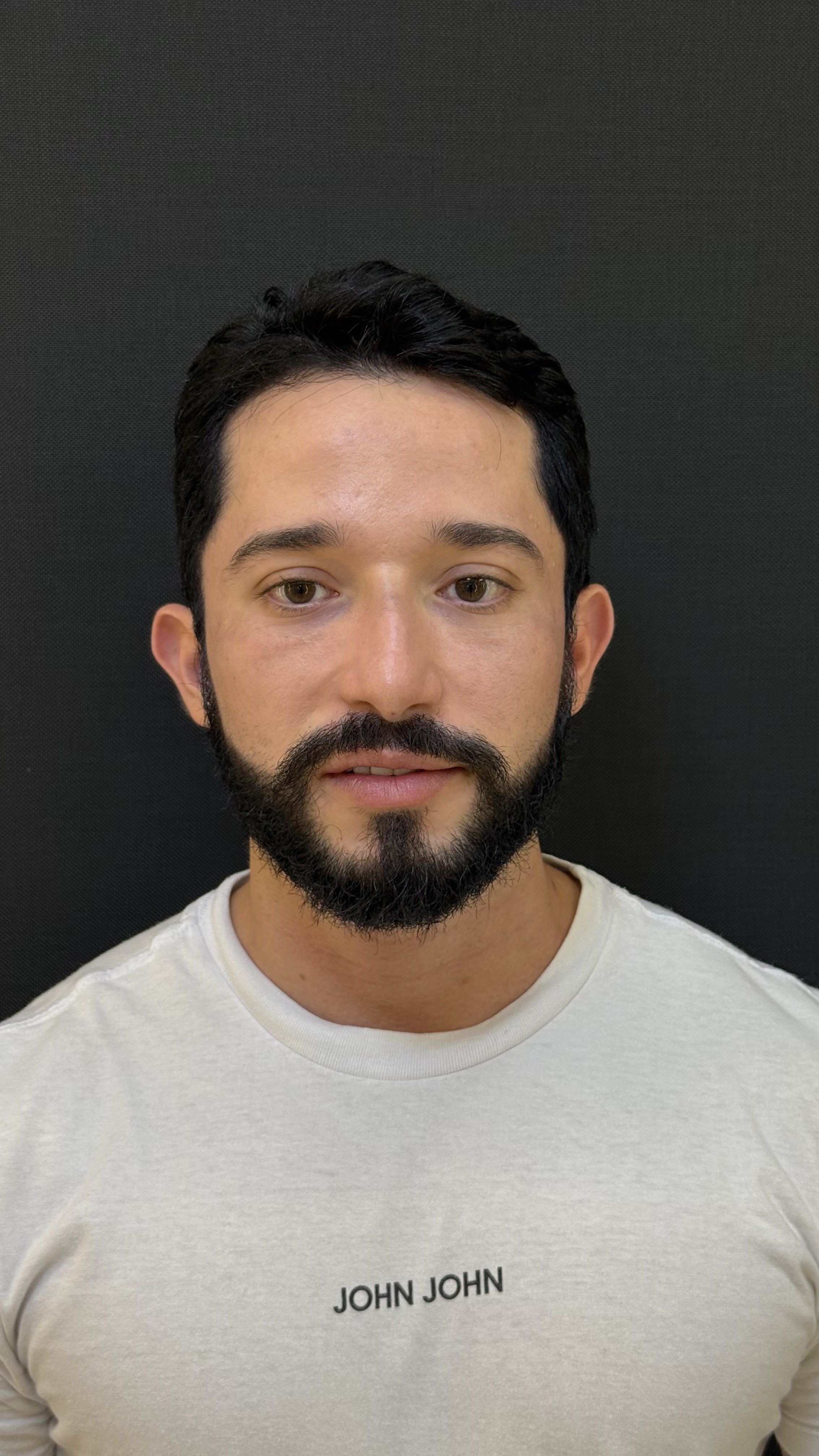 Caso 1 — antes da Otomodelação